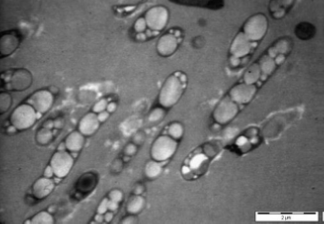 PHAs ภายในเซลล์ของ ralstonia eutrophus