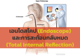 เอนโดสโคป (Endoscope) และการสะท้อนกลับหมด (Total Internal ... พารามิเตอร์รูปภาพ 1