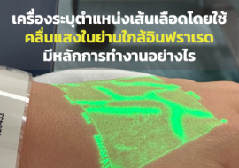 เครื่องระบุตำแหน่งเส้นเลือดโดยใช้ ... พารามิเตอร์รูปภาพ 1